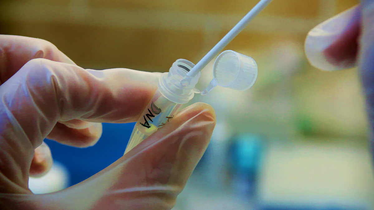 DNA sample collection methods